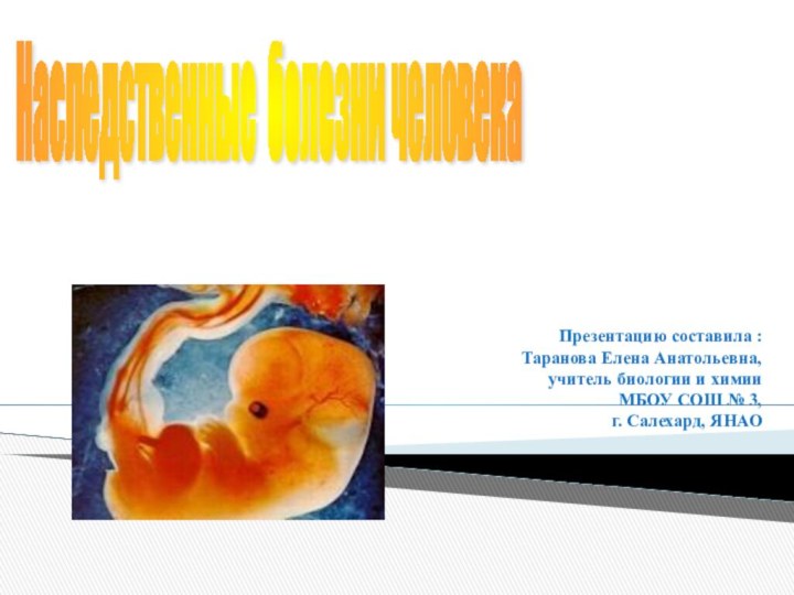 Наследственные болезни человека Презентацию составила : Таранова Елена Анатольевна,учитель биологии и химии