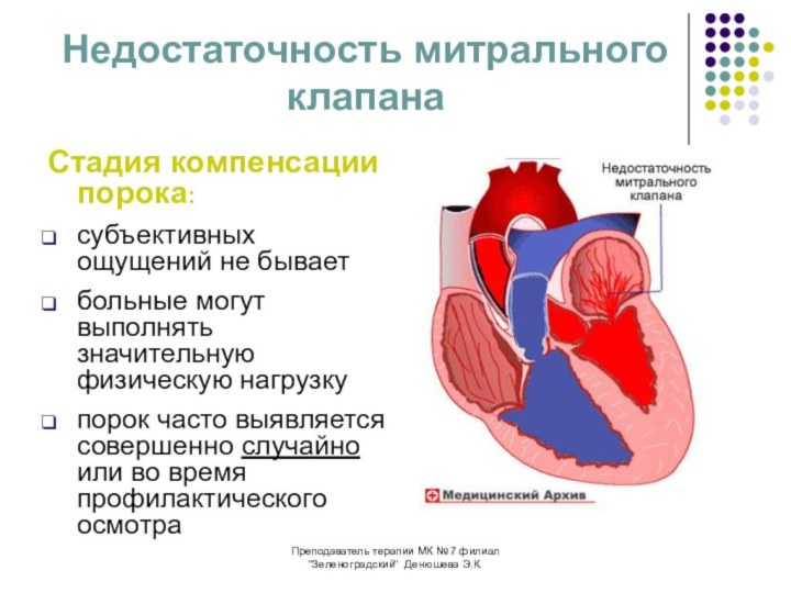 Пороки сердца у детей презентация