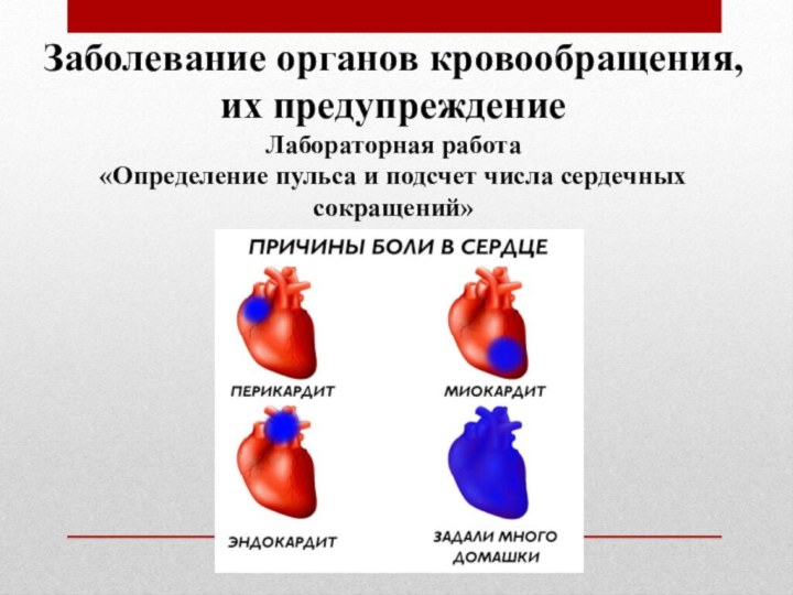 Заболевание органов кровообращения, их предупреждениеЛабораторная работа «Определение пульса и подсчет числа сердечных сокращений»