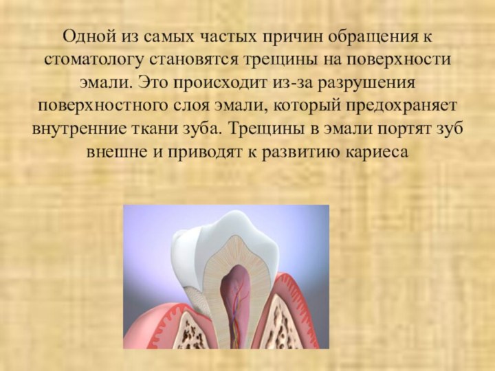 Одной из самых частых причин обращения к стоматологу становятся трещины на
