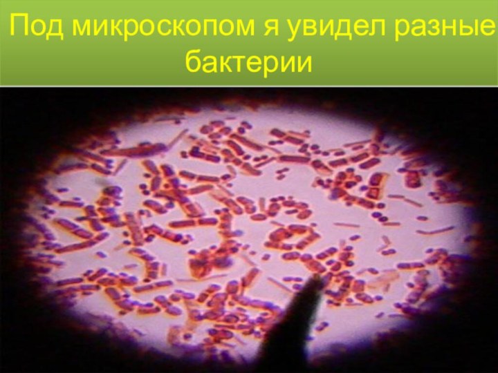 Под микроскопом я увидел разные бактерии